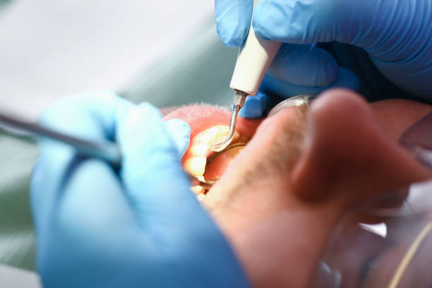 Best Urgent Tooth Repair  in Thousand Palms, CA