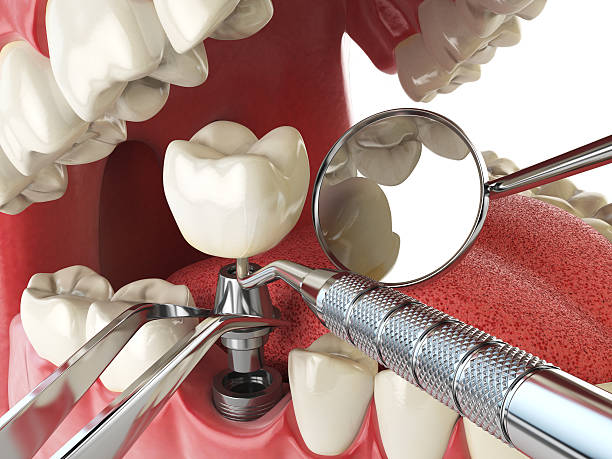 Best Cracked Tooth Emergency Dentist  in Thousand Palms, CA
